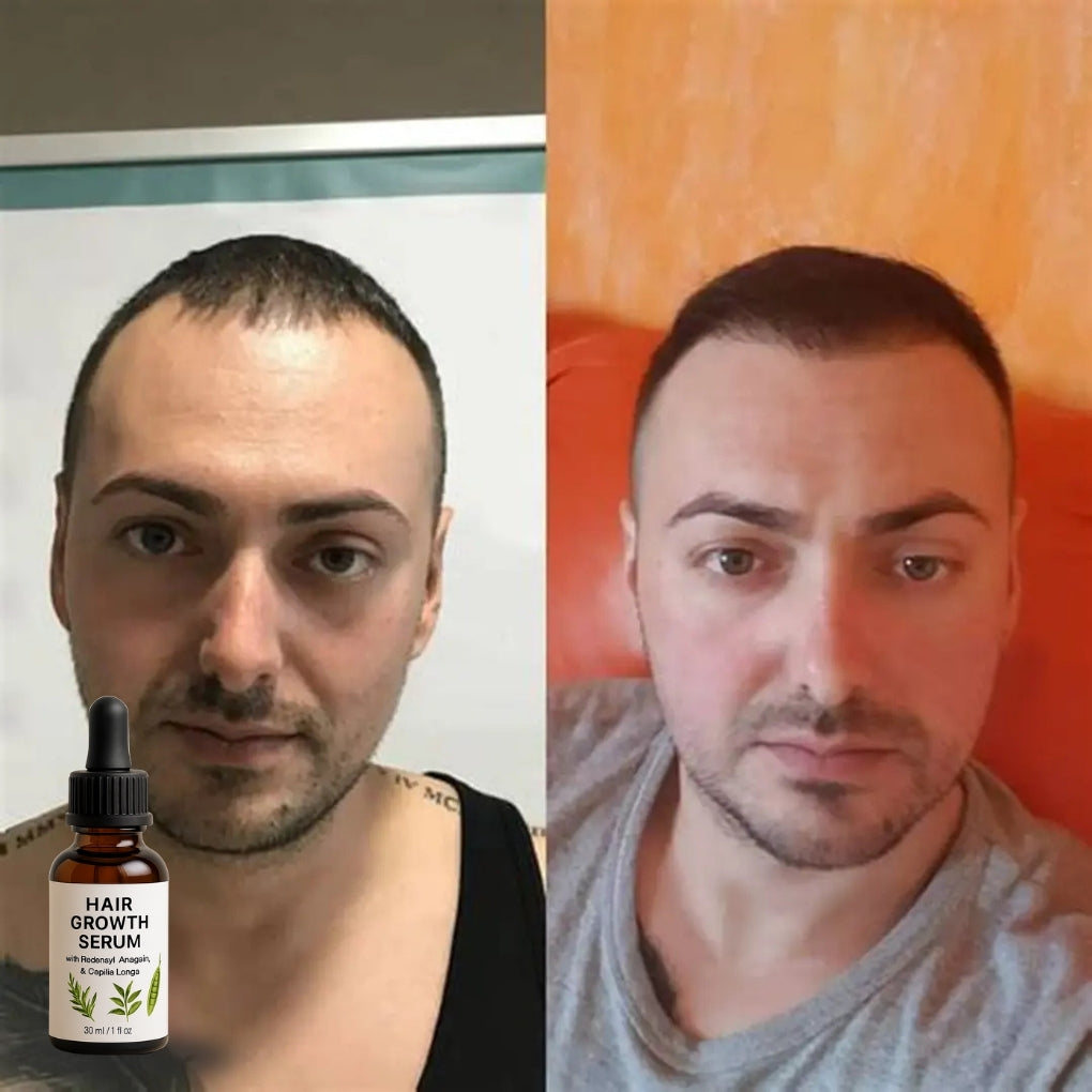Firmelià Sérum Recrecimiento Capilar Post-Tratamiento
