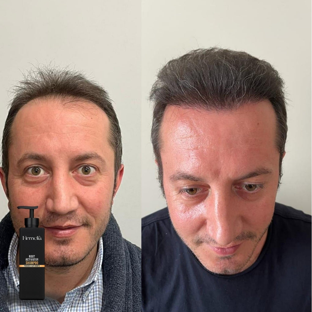 Champú Firmelià Active Follicular Regrowth